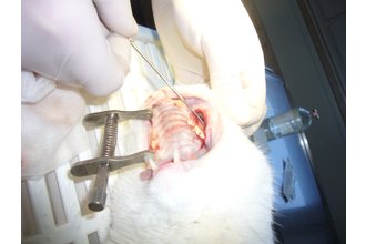 Bißverletzung Oberkiefer mit Zahnfleischablösung