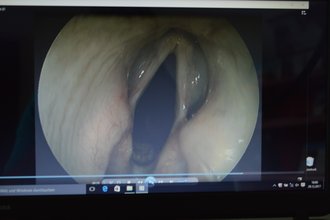 Blick auf den Kehlkopf mittels Endoskopie