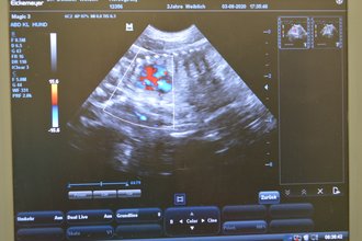 Herzdiagnostik geht auch beim Embryo