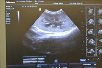 Nierendiagnostik mit Ultraschall