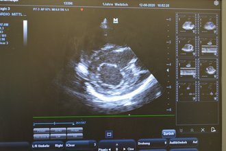 Querschnitt durch das Herz bei Ultraschalluntersuchung